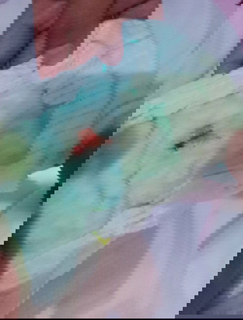 Ask lang po kung normal po ba may dugo sa ihi ni baby? 6 days old na po sya ngayon.