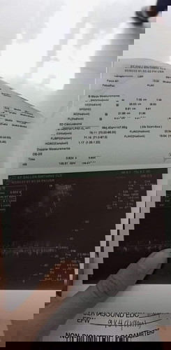 ALL WE KNOW IS PCOS LANG SIYA