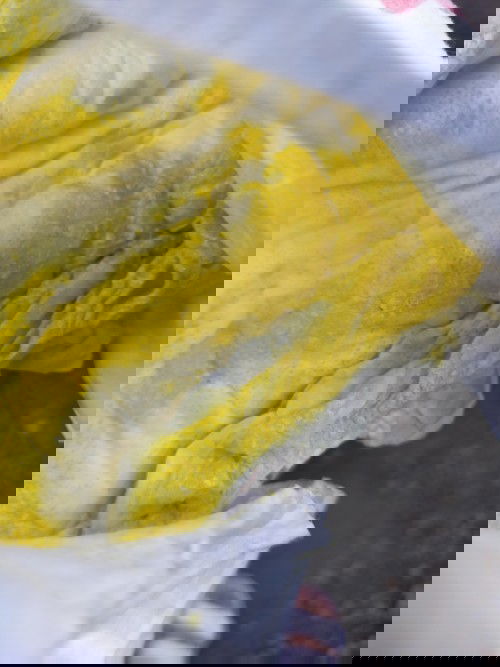 NORMAL LANG PO BA YELLOW POOP NI BABY TAPOS SA ISANG ARAW LIMANG BESES SIYA MAG PO POOP?