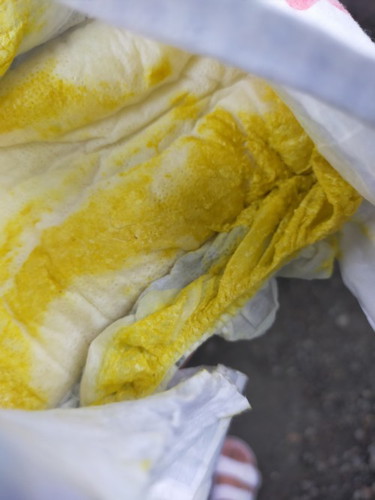 NORMAL LANG PO BA YELLOW POOP NI BABY TAPOS SA ISANG ARAW LIMANG BESES SIYA MAG PO POOP?