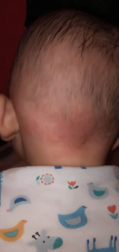 Gatel di belakang kepala