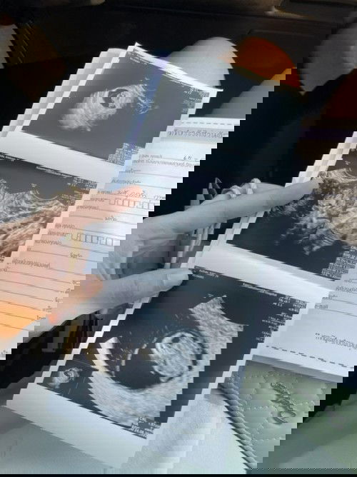 ทายเพศขำๆกันค่ะ