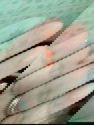 มีมูกเลือดออกแต่ไม่เจ็บท้องค่ะแบบนี้ต้องไปหาหมอมั่ยค่ะ