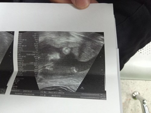 ท้องแรกค่ะ ขอสอบถามแม่ๆหน่อยคะ อยากรู้แบบนี้ ช รึ ญ หรอคะ เราดูไม่เป็นเลย