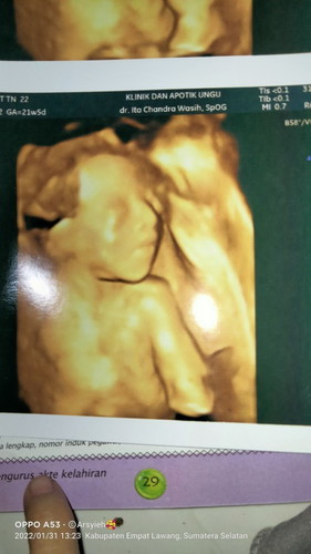 Anak ke 2 si mancungku