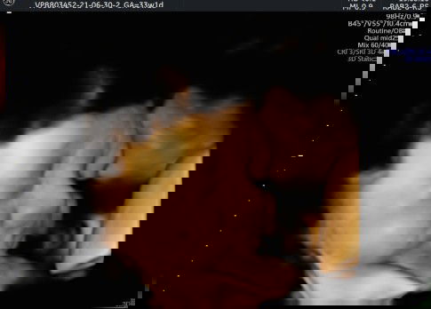 Ciri janin masuk panggul