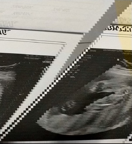 ท้องแรกคะมาแชร์หน่อย