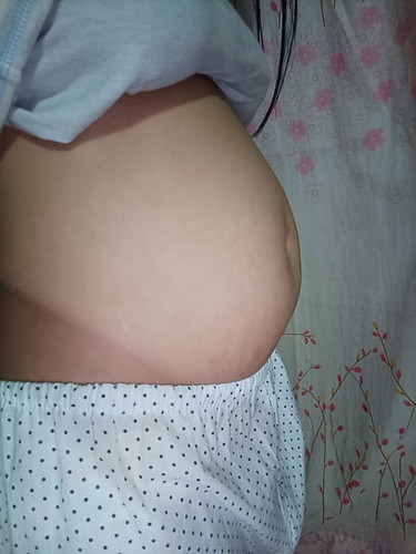 Normal lang Po ba?