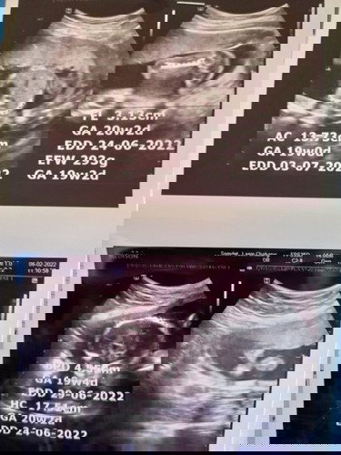 เพศน้องหญิงหรือชาย