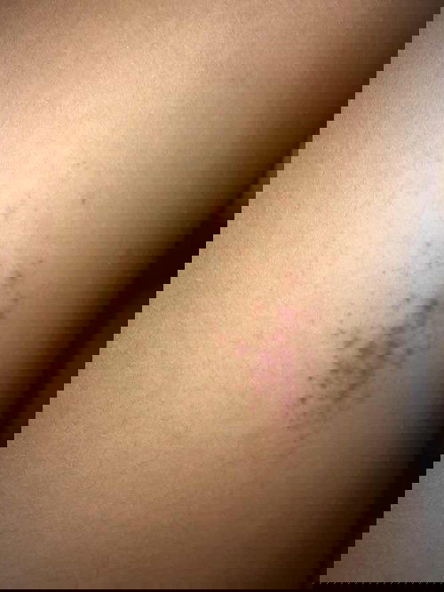 แม่กังวลมากค่ะ