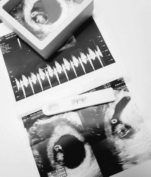 First came Love, then came You.
#ParentsToBe #BabyOnTheWay