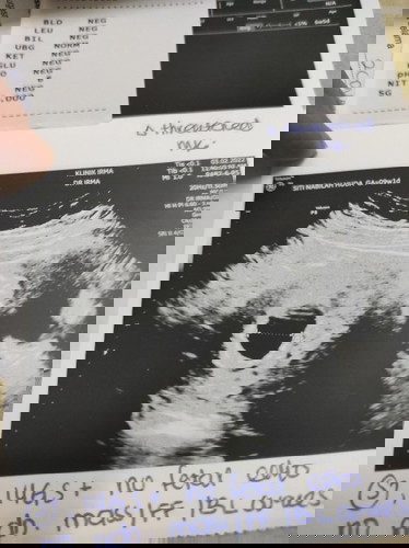Week 9, tapi scan week 6