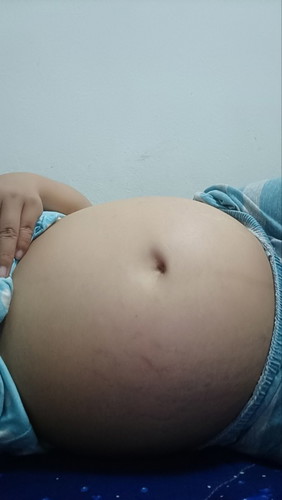 31+3เองอยากรุว่าปกติไหม