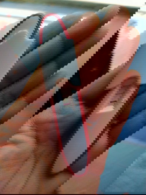 ถุงน้ำรังไงรั่วตั้งครร