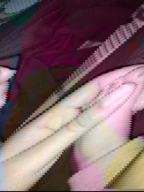 Kaki bayi saya kenapa