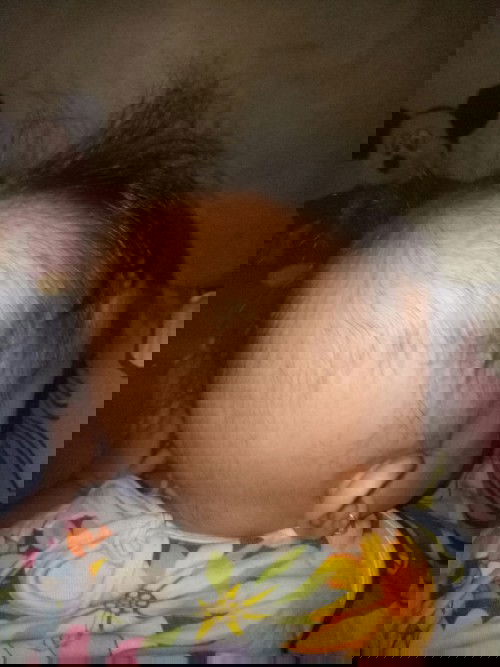 Rambut numbuh g rata