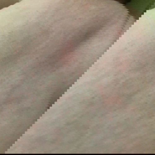 Có con của mom nào bị tình trạng như này không ạ