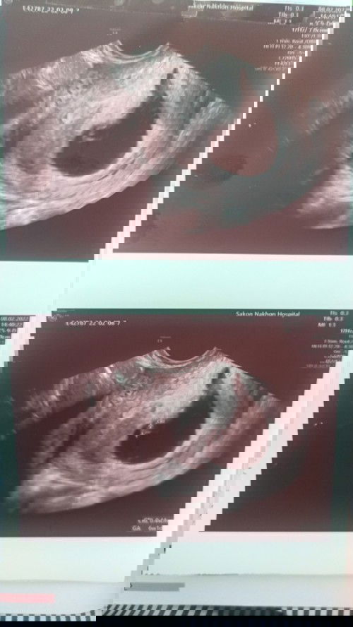 ขอกำลังใจหน่อยค่ะ😭