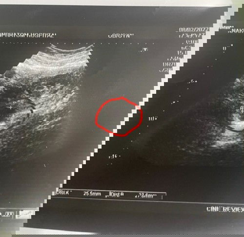 เซอร์ไพรส์แบบพีคๆ