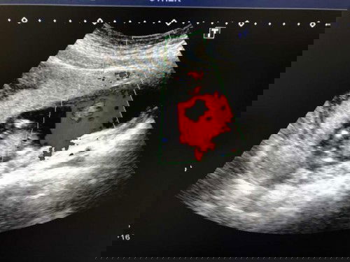 ช่วยดูหน่อยจร้า