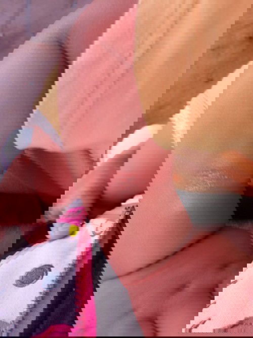 ตุ่มแบบนี้เกิดจากตัวอะไรคะ