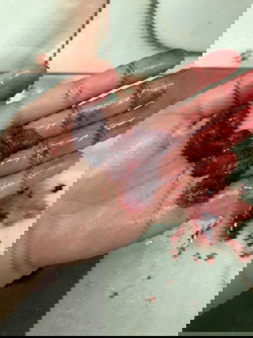 My baby become angle at 5W3D