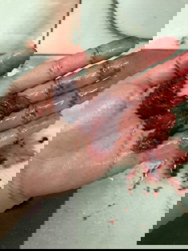 My baby become angle at 5W3D