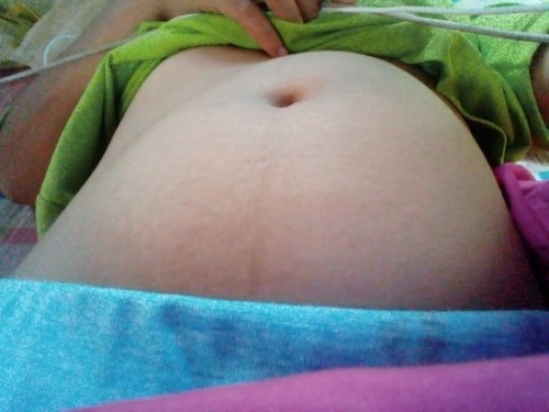 21w3d ท้องแข็ง