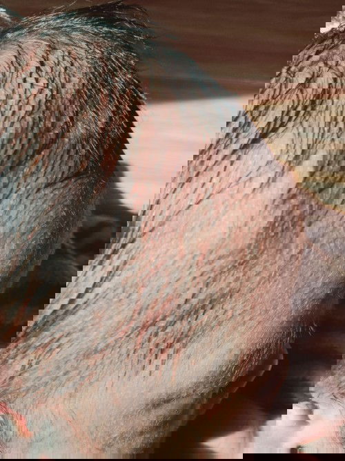 Bintil mirip cacar kecil di bagian kepala