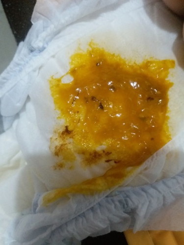 Dumi ng bata