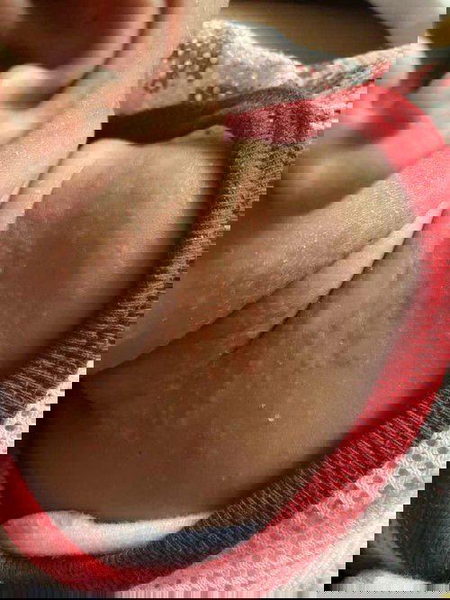 Gatal ke? Atau x? Bahaya x?