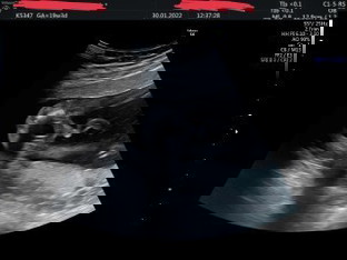 แม่คิดว่าน้องเพศอะไรคะ