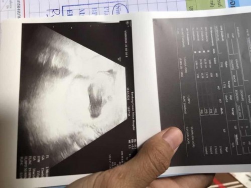 16สัปดาห์บ้านไหนกำหนดคลอดเดือน7บ้างค่ะ