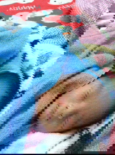 ผื่นขึ้นที่ใบหน้าลูก