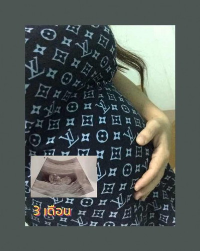 ทีม กรกฎาคม 65 #ท้อง2ใหญ่มากๆ