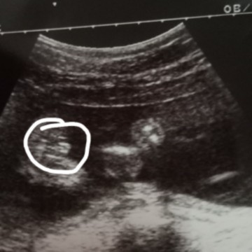 เป็นกลีบแบบนี้ใช่ลูกสาวไหมคะขอถามแม่ๆค่ะ