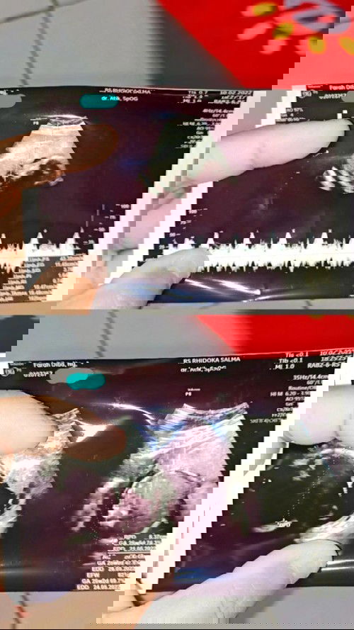 Hpl Mei akhir.. 25minggu 2hari