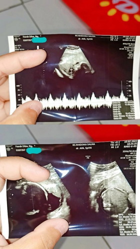 Hpl Mei akhir.. 25minggu 2hari