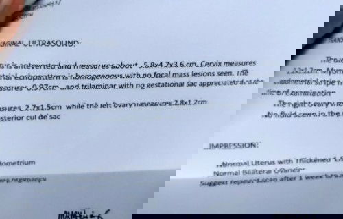 Nag positive 2 times dinugo lang nag negative