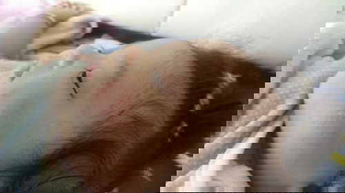 pipi bayi kemerahan dan kering