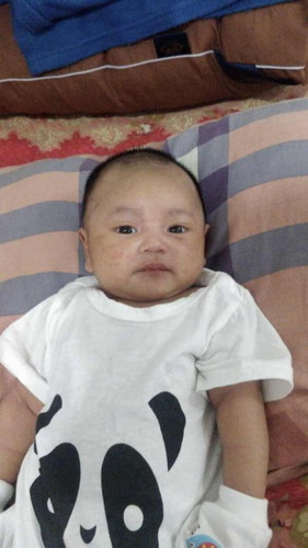 Ruam panas & kering