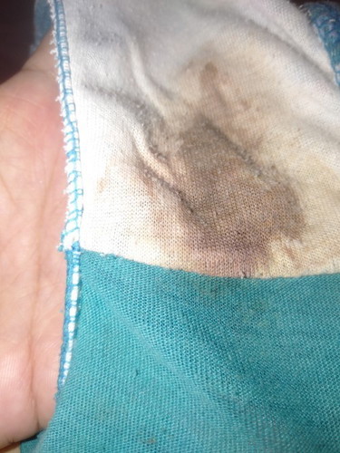 Hello poh sa inyo baka poh meron same case ko dito .8days na ako delay nag pt ako positive