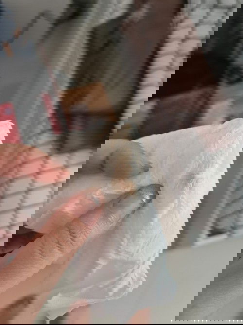 มีสีน้ำตาลอ่อนๆตอนปัสสาวะ