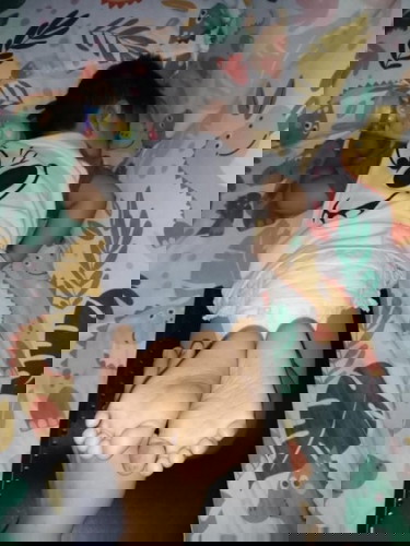 Hindi pantay ang kaliwang hita at binti sa kanan ni baby