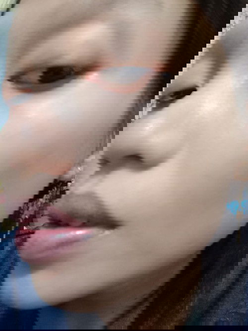 Ada yang sama gak bund sewaktu hamil trimester1-2 wajah pada gatal2 merah 
kayak kesemutan