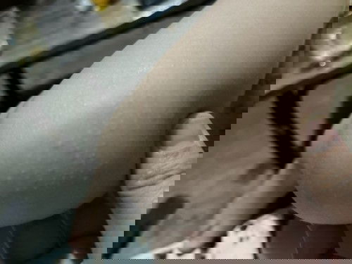 Butlig sa siko at tuhod