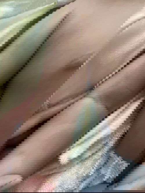 ลูกเป็นปื้นดำๆที่ผิวแบบนี้ จะหายไหม