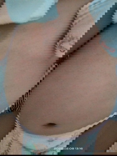 Rashes ba ito