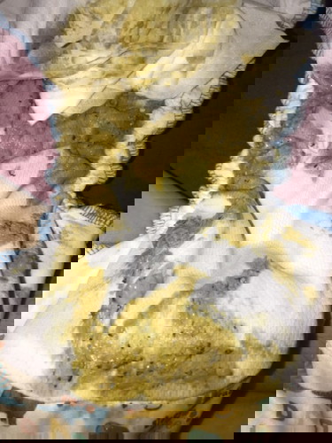 May itim sa tae ni baby (8 months old)