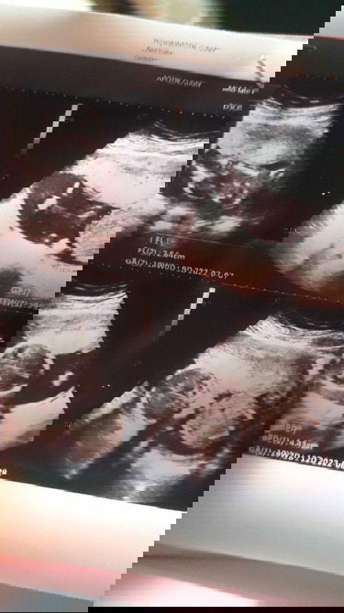 Siutun mulai nendang" 🤗